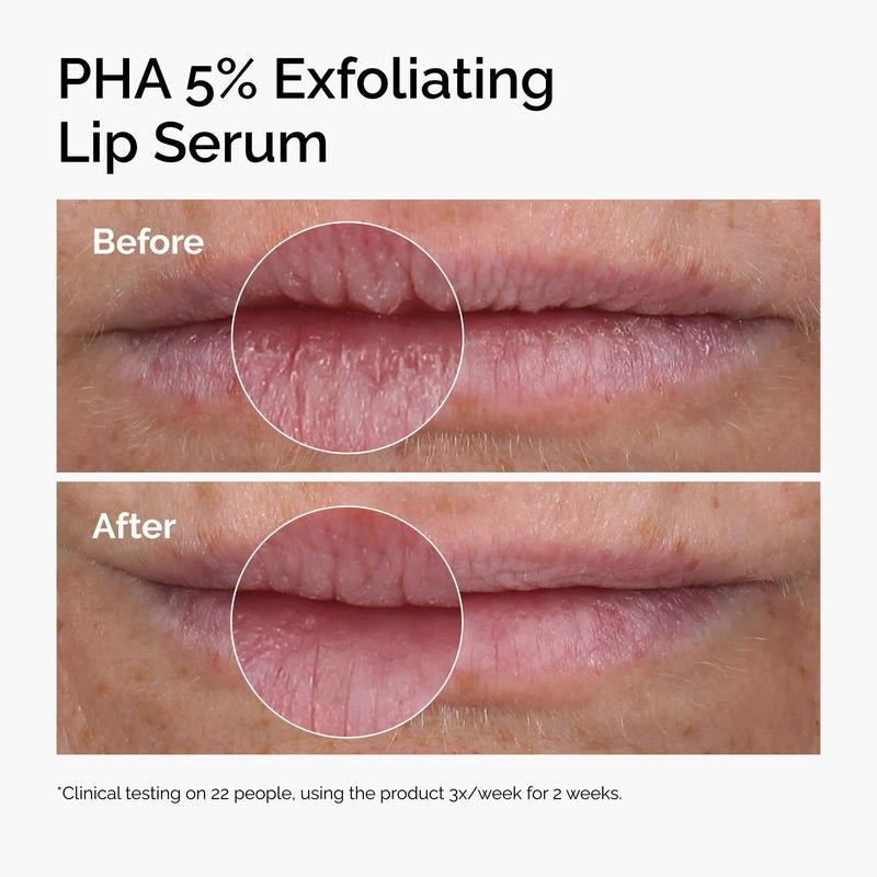 PHA 5% Exfoliating Lip Serum