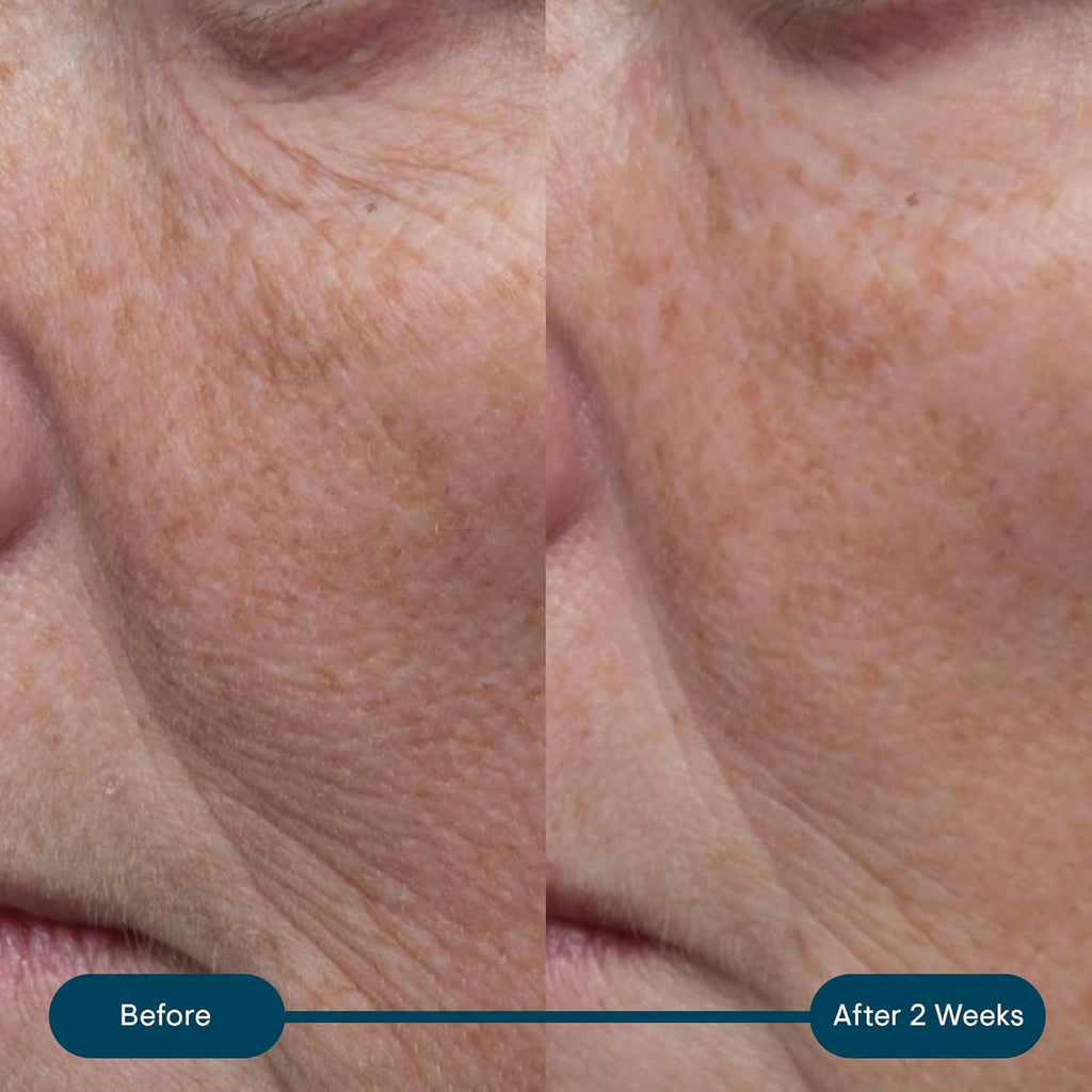 Pro-Collagen Marine Cream SPF30 – Anti-Wrinkle Face Moisturiser, Hydrating Day Cream, 50Ml – Original, Ultra-Rich or Rose